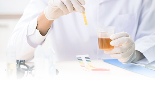 How is the Cause of Haematuria determined?