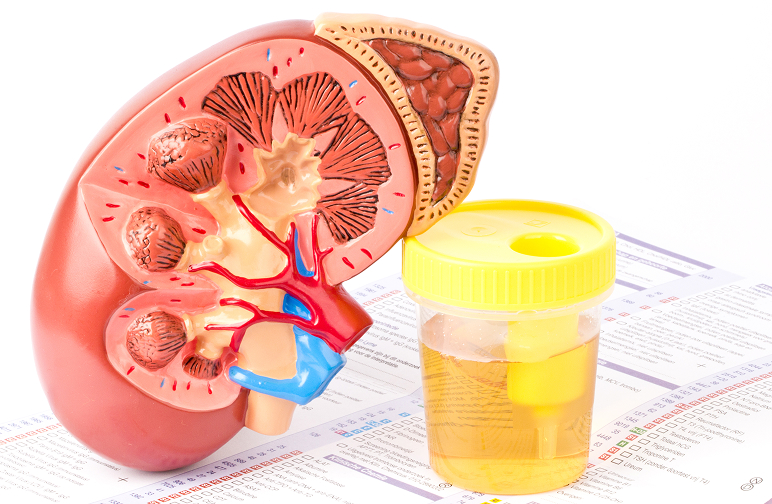 Kidney and Urine Test container