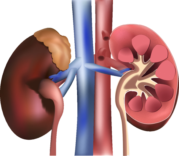 Haematuria Treatment
